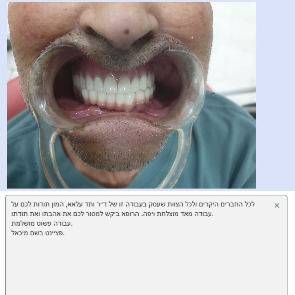 Jüngste Firmenblogs über Joydentalab Zahnprothesenverarbeitungsfabrik: Gewinnen von Patienten aufrichtiges Lob mit Qualität