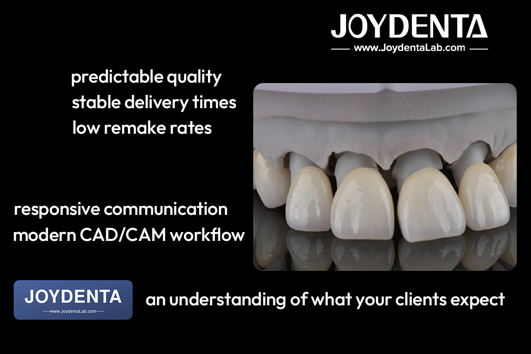 Jüngste Firmenblogs über High-Aesthetic Zirconia Dental Crown Case | Global Outsourcing for Dental Labs – Joydentalab