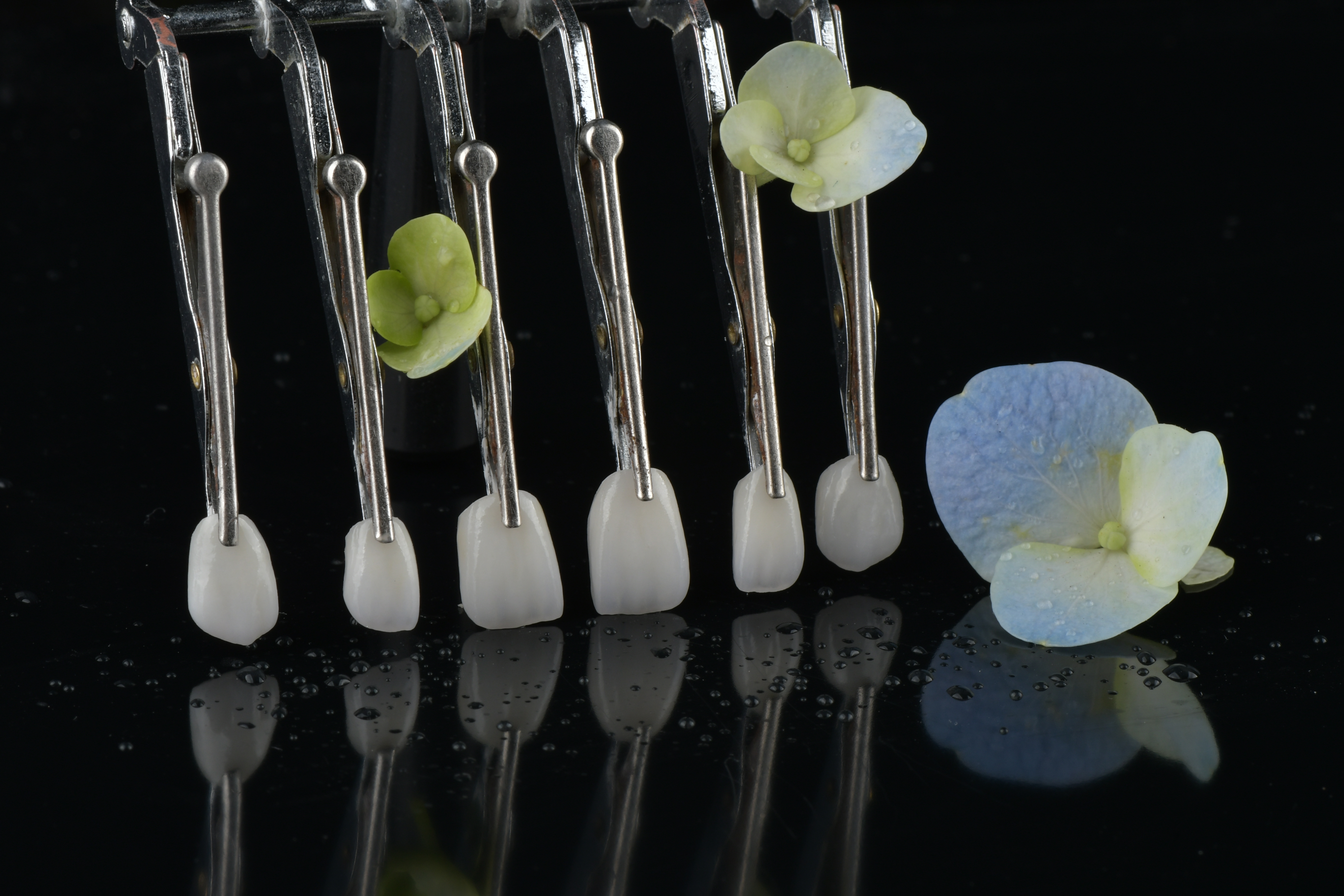 Jüngste Firmenblogs über Erfordern festsitzende Restaurationen Folgetermine?