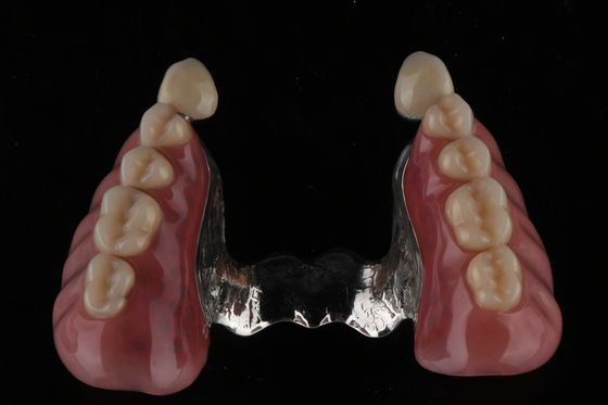 kaufen Schmutzfeste vollwertige Acryl-Zahnprothese Natürliche Acryl-Harz-Zahnprothese Zähne on-line-Fertigung