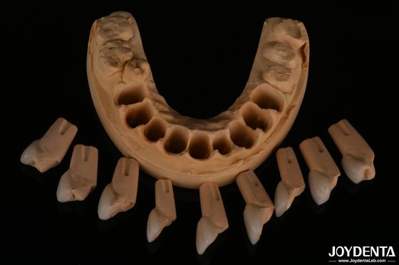 kaufen Präzise Dental Feldspatische Furnier sehr natürlich mit glänzender Oberflächentextur on-line-Fertigung