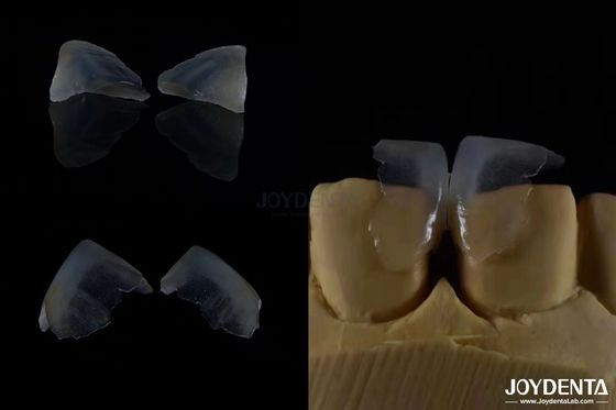 kaufen Minimal-invasive kosmetische Zahnfineren Glas Keramik Farbe ultra dünn on-line-Fertigung