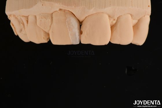 kaufen Kleine Schalen Mikrofolie Kosmetische Zahnbehandlung Kleine Zahnfolien on-line-Fertigung