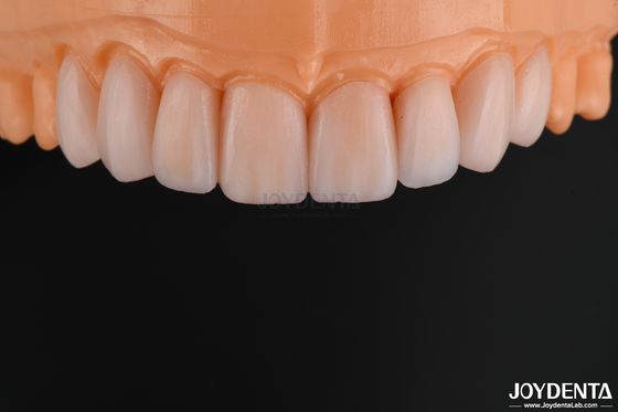 kaufen Anpassungsfähiges Glas Keramik Veneer Naturbild hohe chemische Beständigkeit on-line-Fertigung
