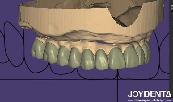 kaufen Individuelles Design Digitale Diagnostik Wax Up Lab Software nahtlose Integration on-line-Fertigung