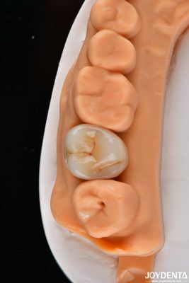 kaufen Zahnpflege Mehrschicht Vollzirkonie Kronen und Brücken Hoch durchscheinend Naturbild on-line-Fertigung