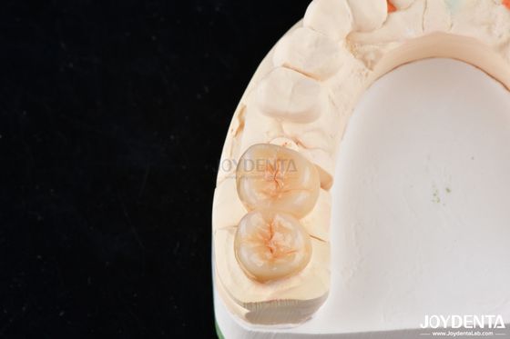 kaufen Natürlich aussehende Zirkonia-Inlays und Onlays für Zahnpflege on-line-Fertigung