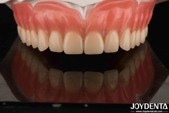 kaufen Acryl-Zähne Veredelung Leichtgewichts-Harz-Material Zahnreparaturen Zahnarrangement on-line-Fertigung