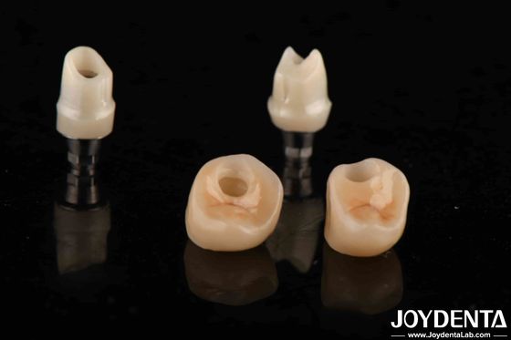 kaufen Silberfarbene Zirkonia-Abtritte für Implantate Anpassungsdurchmesser on-line-Fertigung