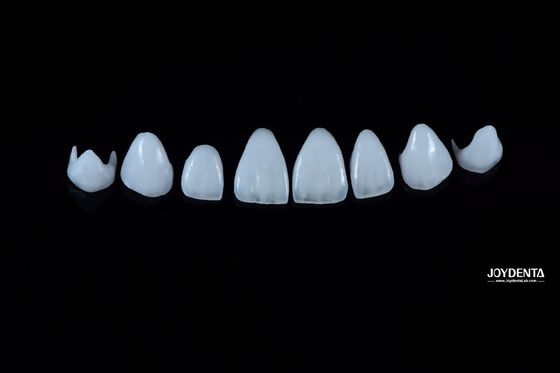 kaufen 0.3-0.5mm Dicke Naturporzellan Emax Veneers Hohe Festigkeit Langlebig für Ästhetik on-line-Fertigung