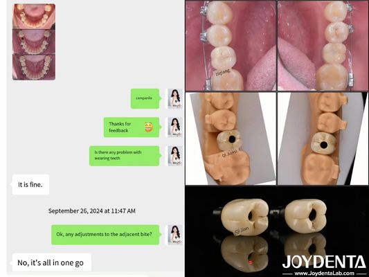 kaufen Langlebige Vollbogen-Zahnimplantate Endosseous Implantat Länge 10 mm-16 mm on-line-Fertigung