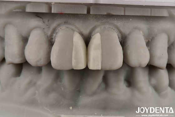 kaufen Krümmte Oberflächen Feuerbeständigkeit Mikrofurnier für Innenarchitektur on-line-Fertigung