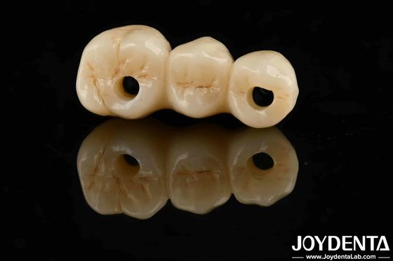 kaufen Hohe Ästhetik Hohe Biegefestigkeit 1000 MPa Vollzirkon für Normen on-line-Fertigung