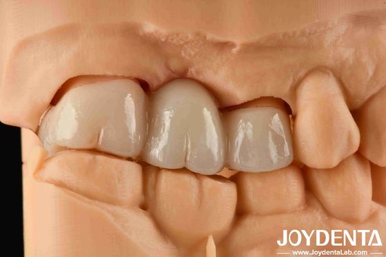 kaufen Erfahrung Farbe realistische Vollzirkonium mit hoher Flexionsbeständigkeit und Biegefestigkeit von 1000 MPa on-line-Fertigung