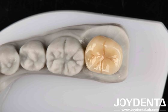 kaufen Hohe Widerstandsfähigkeit gegen Wärmeschläge und Korrosion Vollzirkonium mit ausgezeichneter chemischer Stabilität on-line-Fertigung