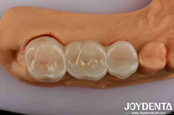 kaufen Hochfeste Zahnzirkonium Ihre ultimative Lösung für eine natürlich aussehende Ästhetik on-line-Fertigung