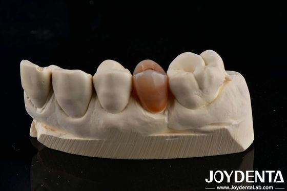 kaufen Biokompatibles und natürlich aussehendes Mehrschicht-Zirkonium mit Ästhetik on-line-Fertigung