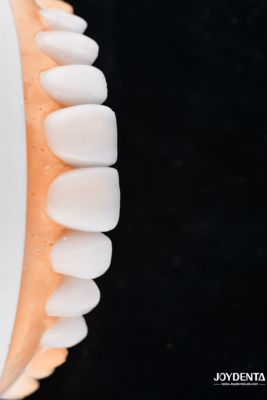 kaufen Enhance Case Acceptance & Patient Communication with Our Diagnostic Wax-Up Service on-line-Fertigung