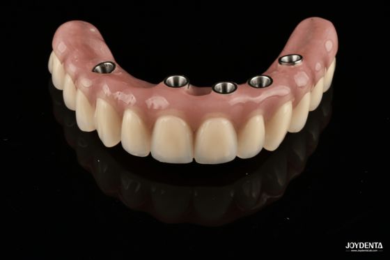 kaufen Redefining Full Arch Prosthetics: Unmatched Fit and Function with Our Ti-Base Complete Dentures on-line-Fertigung