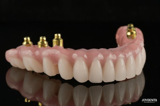 kaufen The Strength of Titanium, The Art of Natural Aesthetics. on-line-Fertigung