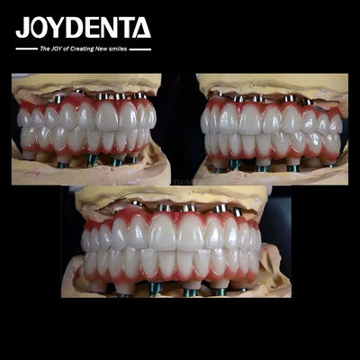 kaufen 10 mm Titanium Mehrzahnimplantat Raue Oberfläche zur Zahnwiederherstellung on-line-Fertigung