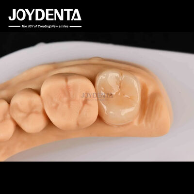 kaufen Hohe Festigkeit Emax Inlay Onlay A2 Farbe Langlebig für die Wiederherstellung beschädigter Zähne on-line-Fertigung