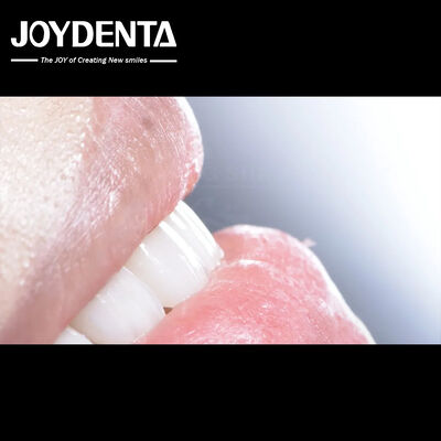 kaufen Langlebige Dental Composite Veneer Gute Biokompatibilität on-line-Fertigung