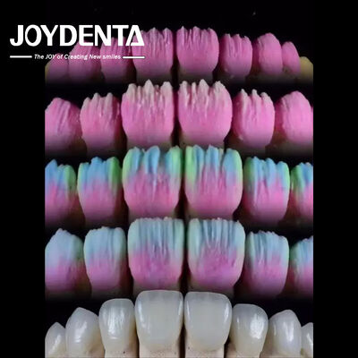 kaufen The Joydenta Ceramic Veneer Process on-line-Fertigung