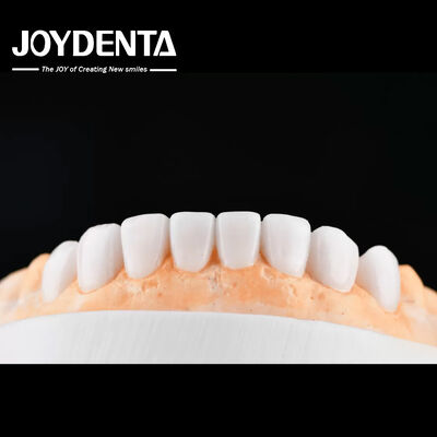 kaufen Enhance Case Acceptance & Patient Communication with Our Diagnostic Wax-Up Service on-line-Fertigung