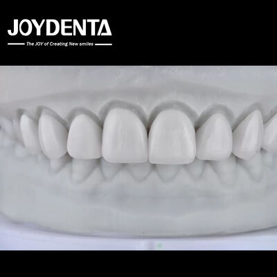 kaufen Visualize the Result, Secure the Case: Our Diagnostic Wax-Up Service on-line-Fertigung