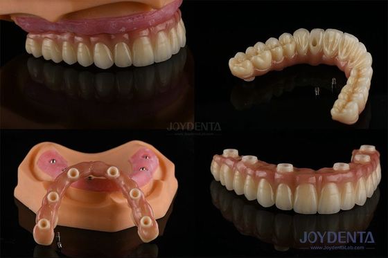Ivoclar Implantat Kugel Anschlüsse Abnehmbares Zahnimplantatmaterial für die Mundhygiene