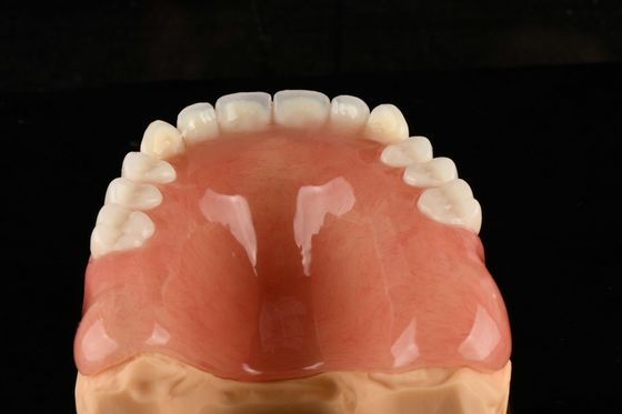 Natürlich aussehende Acryl-Pflanzenzähne künstliche Acrylzähne für lang anhaltende Bequemlichkeit