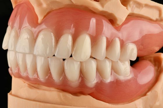 Unsichtbare vollständige / teilweise Zahnprothesen Geruchlose Hypoallergene Acrylentfernbare Zahnprothesen