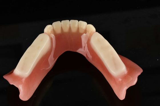Hypoallergene künstliche Acrylzähne für den natürlichen Zahnersatz