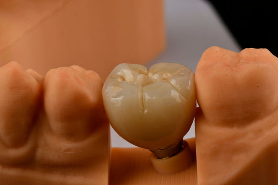 Oral Implantologie Selbstklemmen Einzahn-Zahn-Zahnimplantate mit interner Hex-Verbindung