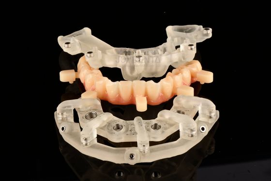 Titanium-statisch geführte Operationslösungen für die Implantattherapie
