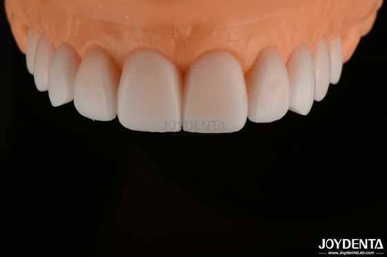 Glatte, replizierte Diagnosewachs, FDA, Vollbogen Zahnwachs, sehr genau.