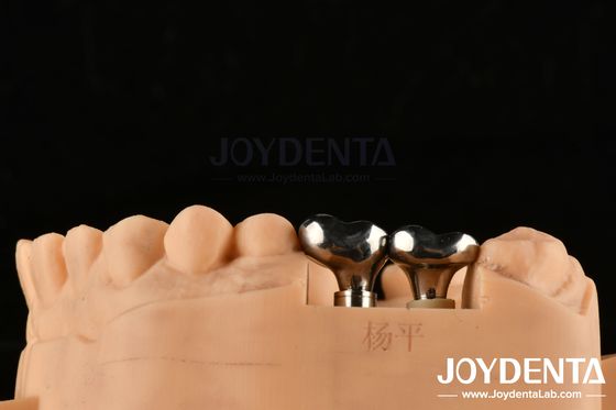 Silber Implantat Abutments angepasster Durchmesser Höhe CAD CAM Technologie
