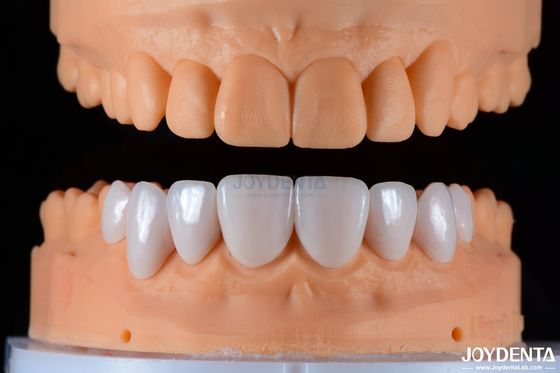 Sichere Porzellanschichten Keramische und natürliche Ästhetik mit starker Haftung