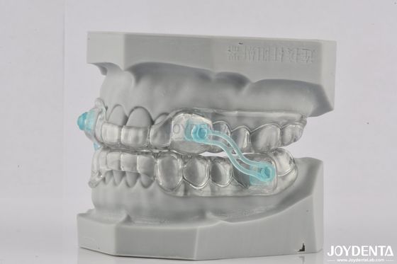 Erwachsene Silikon Transparent Schnarchgerät Schnarch Stopper Tool Transparente Farbe