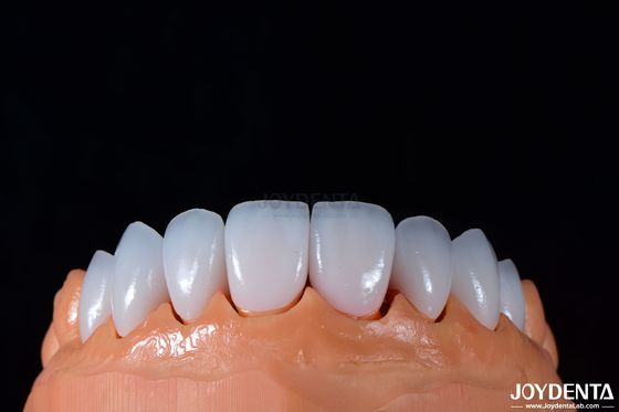 0.3-0.5mm Dicke Emax Porzellanfolie für hochglänzende kosmetische Zahnmedizin