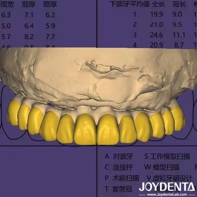 Dental Design Software Digital Wax Up mit HIPAA-konforme Datensicherheit