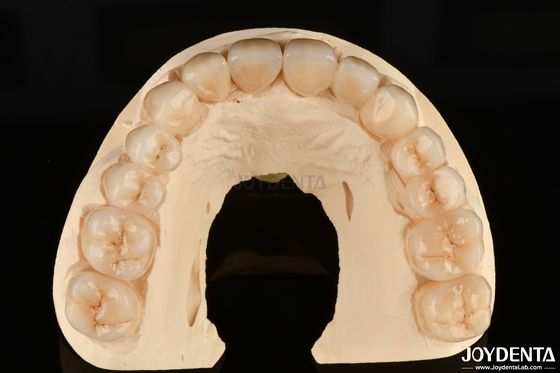 Hohe Korrosionsbeständigkeit Vollzirkonium Das bevorzugte Material für Zahnwiederherstellung