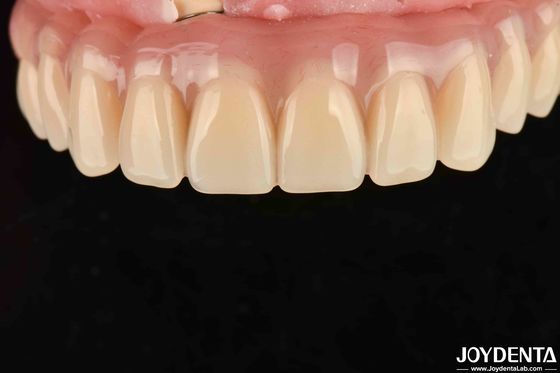 Schnelle Trocknung 5 Minuten Acryl-Zähne-Finish für Zahnrestaurierung