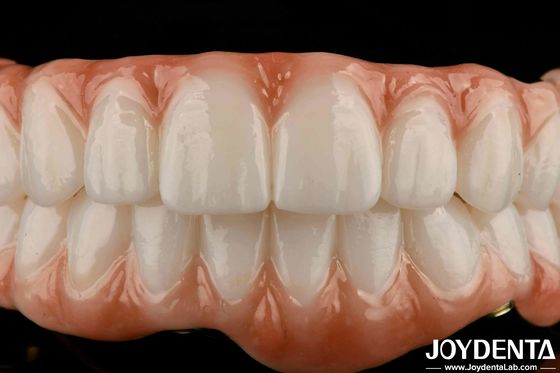 Langlebige Titanbar Zirkonia Hybridbrücke Natürliche Aussehen Ästhetik zur Restaurierung