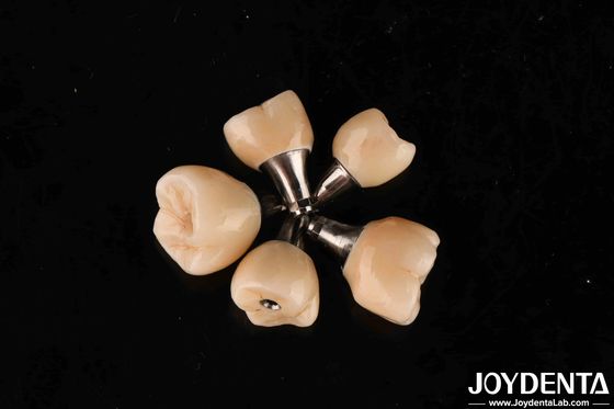 Schraubrückhalt Titanium Abutments Internal Hex Verbindung für Zahnimplantate