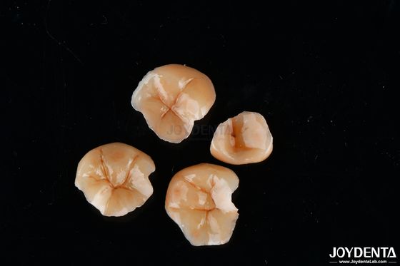 Anpassungsfähige Zusammensetzung Inlays und Onlays Zahnfleckenbeständigkeit Langlebig