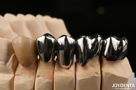 Oral-Klinische Reparatur FMC Vollmetallkrone mit Wachs Gießen Produktionsmethode