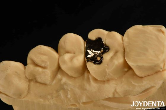 Klinische metallische zahnärztliche Goldkrone 60K Gold Zahnkappe für die Mundrehabilitation