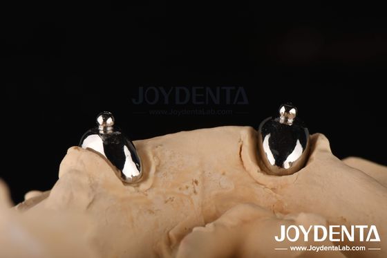 Joydental Zahnarzt Labor Ball Anschluss
